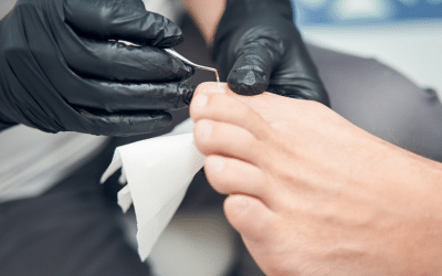 Pediküre in Merchweiler bei Beauty in Perfection: Mehr als nur Nagellack